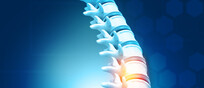 Colonna vertebrale umana e le sue lesioni. fonte: Rasi Bhadramani - iStock